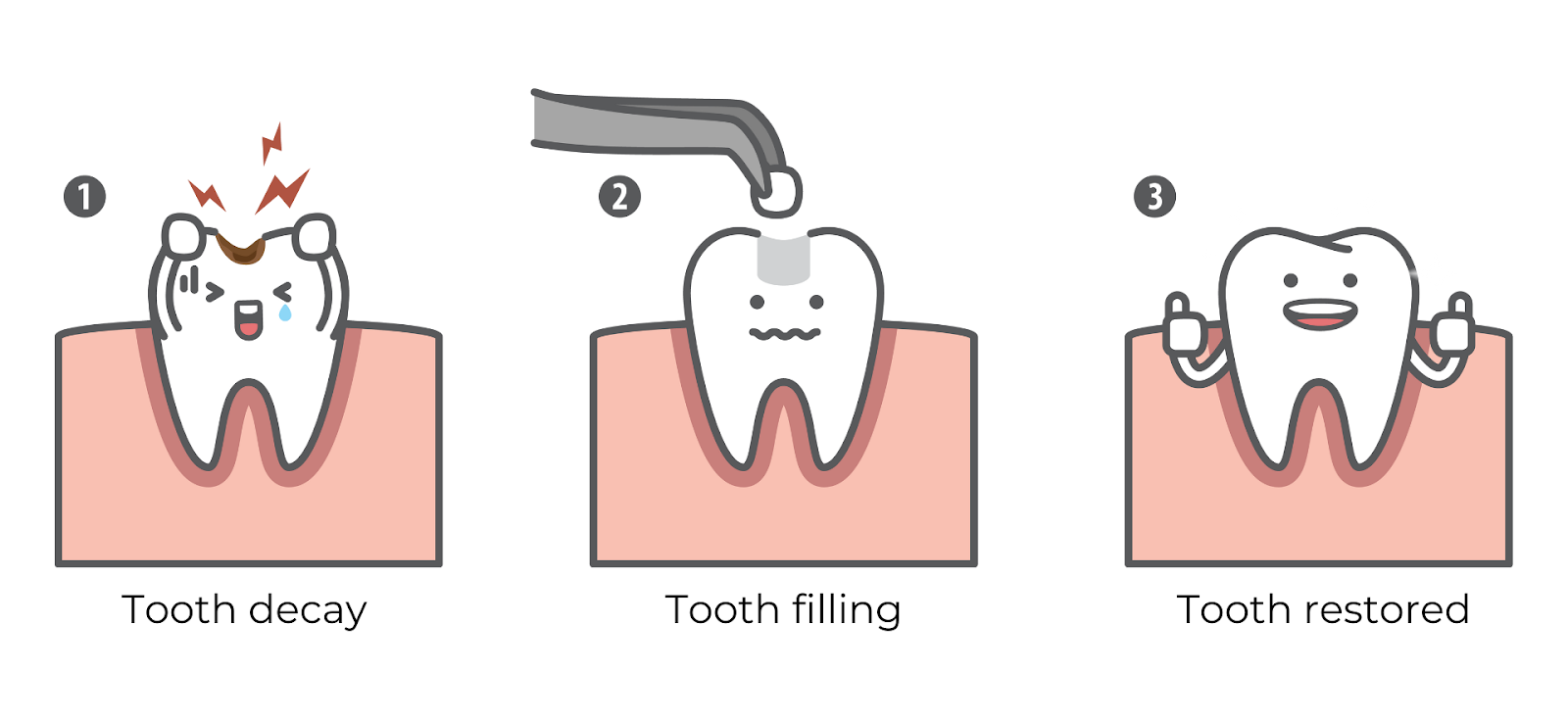 Illustration showing tooth decay, tooth filling procedure, and restored healthy tooth