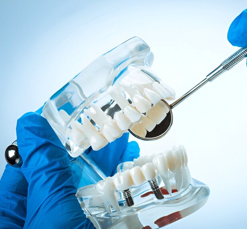 Inlays and Onlays in Sherwood Park